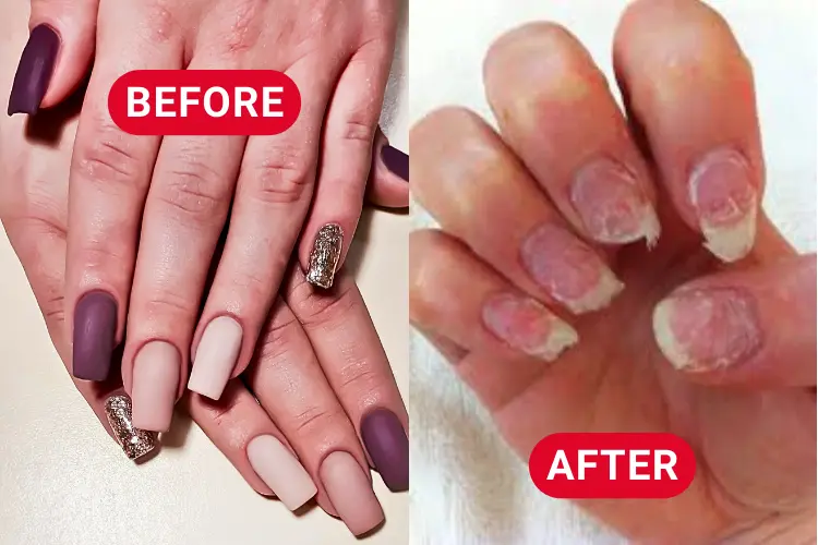 Nail Extensions: The Hidden Dangers Behind Those Glamorous Nails!